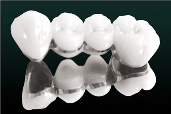 烤瓷牙什么人不能做 烤瓷牙能用沖牙器嗎 烤瓷牙什么人不能做 烤瓷牙能用沖牙器嗎