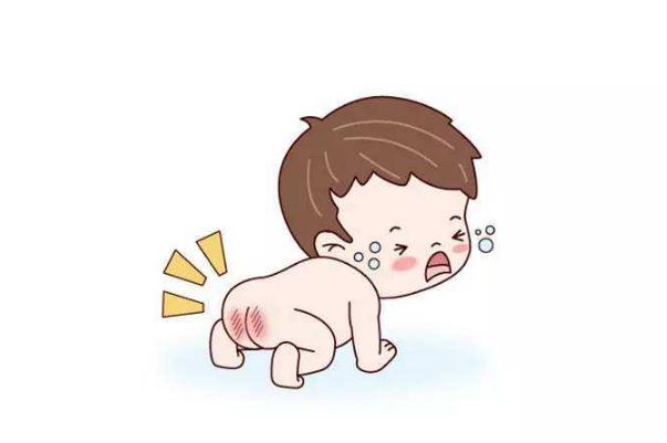 寶寶紅屁股可以用爽身粉嗎 寶寶紅屁股可以用香油嗎 寶寶紅屁股可以用爽身粉嗎 寶寶紅屁股可以用香油嗎