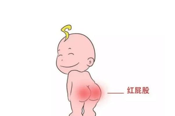 寶寶紅屁股是不是尿不濕造成 寶寶紅屁股是過(guò)敏癥狀嗎 寶寶紅屁股是不是尿不濕造成 寶寶紅屁股是過(guò)敏癥狀嗎