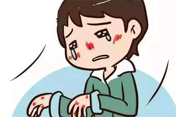 凍瘡能自愈嗎 凍瘡一般多久能好 凍瘡能自愈嗎 凍瘡一般多久能好