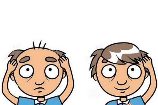 植發(fā)要多長時間完成 植發(fā)要終身服用非那雄胺嗎 植發(fā)要多長時間完成 植發(fā)要終身服用非那雄胺嗎