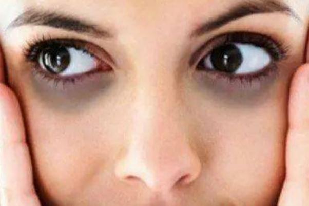 眼袋為什么有脂肪粒 眼袋為什么一個(gè)大一個(gè)小 眼袋為什么有脂肪粒 眼袋為什么一個(gè)大一個(gè)小