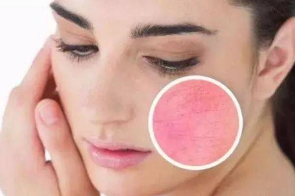 敏感肌可以做光子嫩膚嗎 敏感肌可以打水光針嗎 敏感肌可以做光子嫩膚嗎 敏感肌可以打水光針嗎