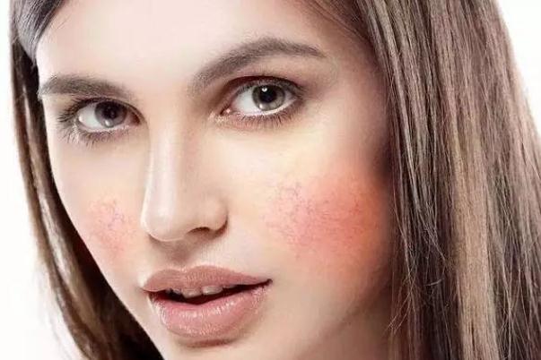 敏感肌是天生的嗎 敏感肌是因?yàn)槠つw缺水嗎 敏感肌是天生的嗎 敏感肌是因?yàn)槠つw缺水嗎