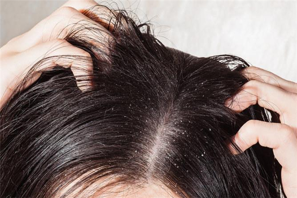 油性頭發(fā)可以用護發(fā)精油嗎 油性頭發(fā)用護發(fā)精油好不好 油性頭發(fā)可以用護發(fā)精油嗎 油性頭發(fā)用護發(fā)精油好不好