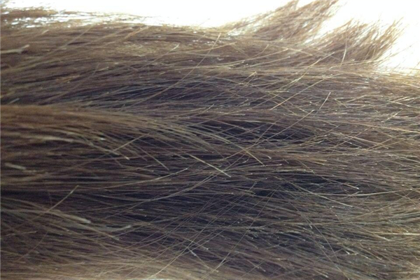 頭發(fā)有分叉會(huì)不會(huì)影響頭發(fā)的生長 頭發(fā)有分叉的原因 頭發(fā)有分叉會(huì)不會(huì)影響頭發(fā)的生長 頭發(fā)有分叉的原因