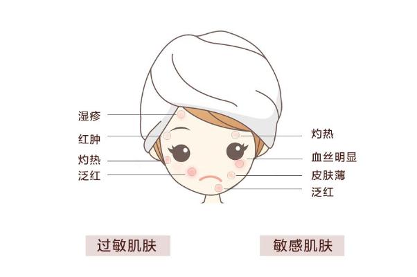 敏感肌怎樣修復(fù)成正常肌膚 敏感肌膚適合什么牌子的護膚品 敏感肌怎樣修復(fù)成正常肌膚 敏感肌膚適合什么牌子的護膚品