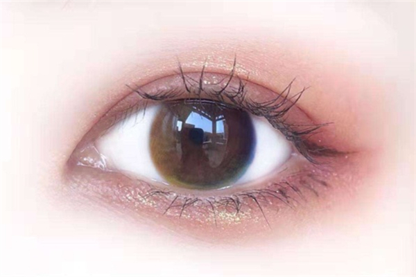 美瞳過期了還能繼續(xù)戴嗎 美瞳過期戴上會(huì)有什么異樣 美瞳過期了還能繼續(xù)戴嗎 美瞳過期戴上會(huì)有什么異樣