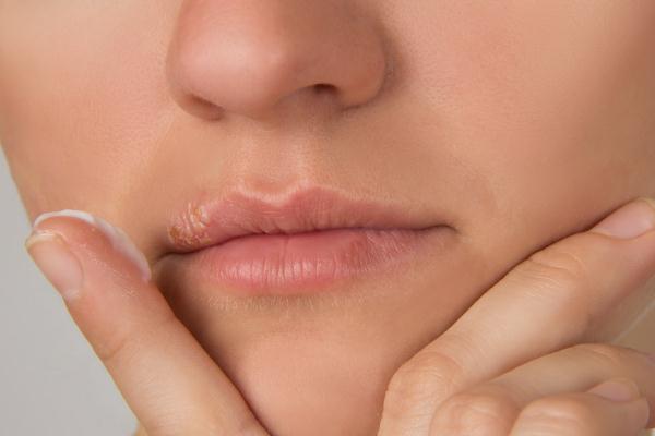 唇毛會自己慢慢消失嗎 唇毛會自己脫落嗎 唇毛會自己慢慢消失嗎 唇毛會自己脫落嗎