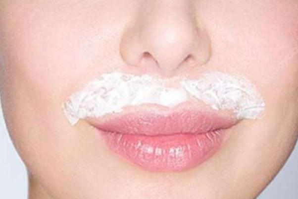 唇毛會自己慢慢消失嗎 唇毛會自己脫落嗎 唇毛會自己慢慢消失嗎 唇毛會自己脫落嗎