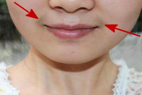 唇毛是脫毛好還是漂白好 唇毛是什么原因?qū)е碌? alt=