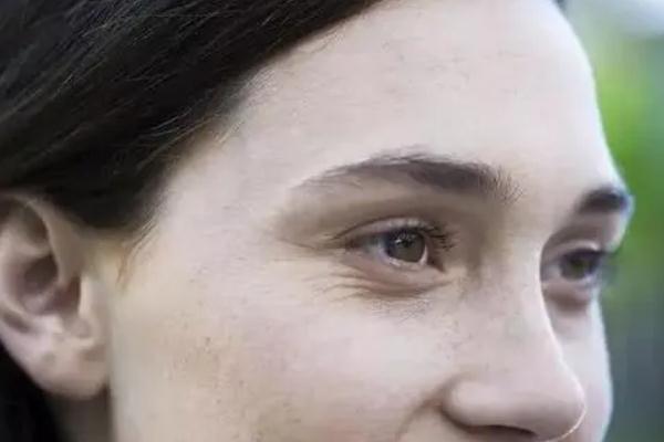 眼部細(xì)紋貼眼膜有用嗎 眼部細(xì)紋是怎么造成的 眼部細(xì)紋貼眼膜有用嗎 眼部細(xì)紋是怎么造成的