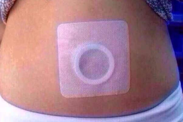 肚臍貼的作用與功效 肚臍貼真的可以祛濕減肥嗎 肚臍貼的作用與功效 肚臍貼真的可以祛濕減肥嗎