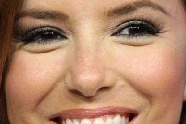 眼部細(xì)紋貼眼膜有用嗎 眼部細(xì)紋是怎么造成的 眼部細(xì)紋貼眼膜有用嗎 眼部細(xì)紋是怎么造成的