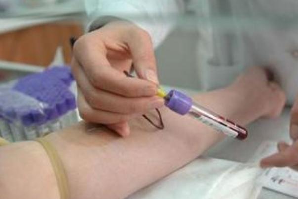 體檢抽血檢查哪些項目 體檢抽血需要空腹嗎 體檢抽血檢查哪些項目 體檢抽血需要空腹嗎