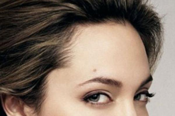 激光洗眉能徹底洗干凈嗎 激光洗眉的紅印多久可以消退 激光洗眉能徹底洗干凈嗎 激光洗眉的紅印多久可以消退