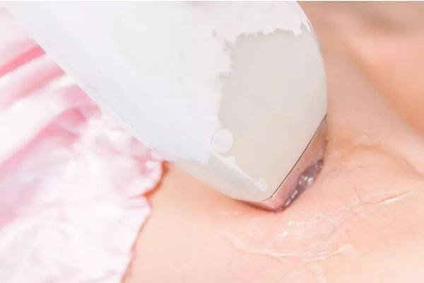 冰點(diǎn)脫毛的光對(duì)眼睛有傷害嗎 冰點(diǎn)脫毛會(huì)影響眼睛嗎 冰點(diǎn)脫毛的光對(duì)眼睛有傷害嗎 冰點(diǎn)脫毛會(huì)影響眼睛嗎