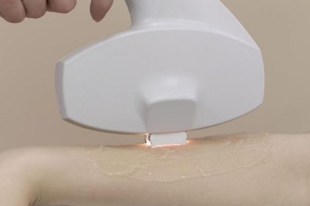 冰點(diǎn)脫毛隔十天能做么 冰點(diǎn)脫毛對(duì)身體有沒有傷害 冰點(diǎn)脫毛隔十天能做么 冰點(diǎn)脫毛對(duì)身體有沒有傷害