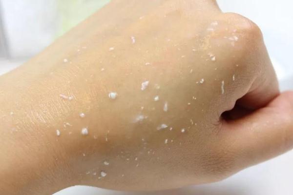 去角質(zhì)的產(chǎn)品哪款好用 去角質(zhì)對(duì)痘痘有用嗎 去角質(zhì)的產(chǎn)品哪款好用 去角質(zhì)對(duì)痘痘有用嗎