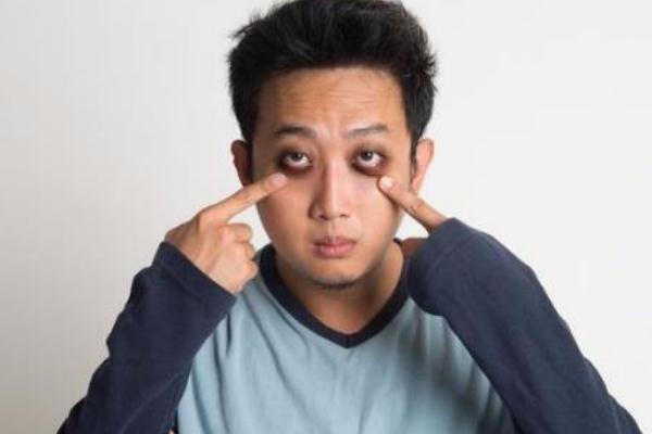 黑眼圈很重怎么去除 黑眼圈為什么很重 黑眼圈很重怎么去除 黑眼圈為什么很重