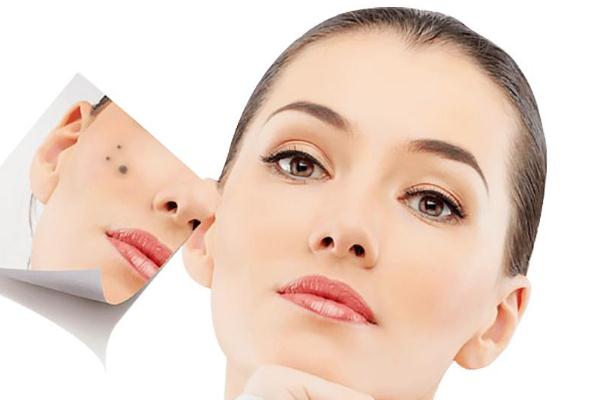 點(diǎn)痣去醫(yī)院掛什么科 點(diǎn)痣后需要注意什么事項(xiàng) 點(diǎn)痣去醫(yī)院掛什么科 點(diǎn)痣后需要注意什么事項(xiàng)