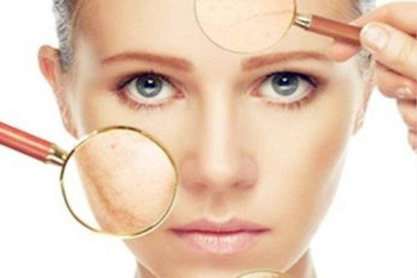 曬斑是什么 曬斑是如何形成的 曬斑是什么 曬斑是如何形成的