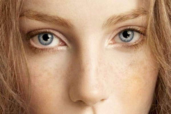 曬斑可以自然消失嗎 曬斑可以用激光去掉嗎 曬斑可以自然消失嗎 曬斑可以用激光去掉嗎