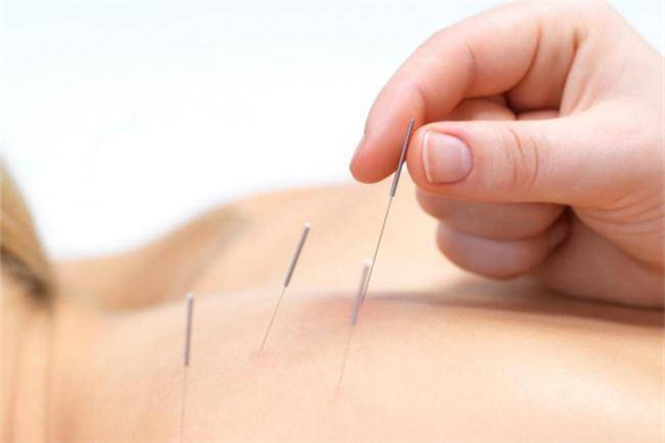 針灸對腰間盤突出有用嗎 針灸是什么原理治病 針灸對腰間盤突出有用嗎 針灸是什么原理治病
