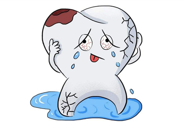 補(bǔ)牙是越貴越好嗎 補(bǔ)牙最好的方式