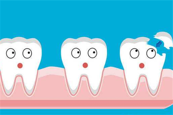 補牙前封牙是什么意思 補牙前為什么要塞藥一個星期 補牙前封牙是什么意思 補牙前為什么要塞藥一個星期