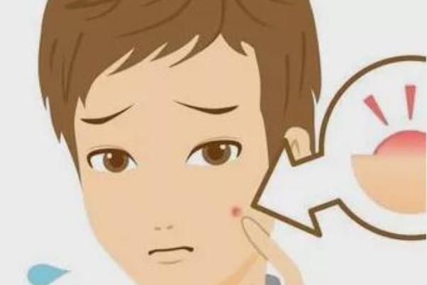 青春痘的原因是什么 青春痘的痘印怎么消除 青春痘的原因是什么 青春痘的痘印怎么消除