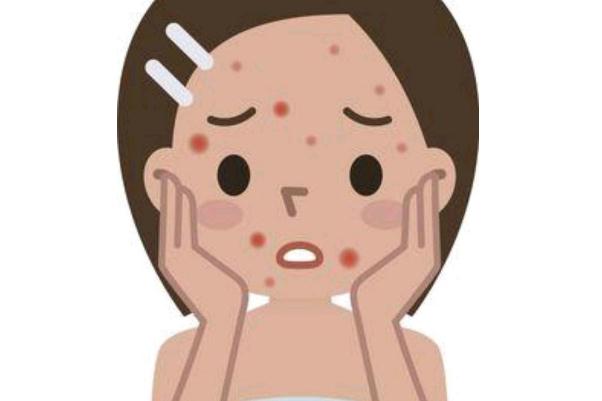 青春痘留下的疤痕怎么才能消除掉 青春痘和痤瘡有什么區(qū)別 青春痘留下的疤痕怎么才能消除掉 青春痘和痤瘡有什么區(qū)別