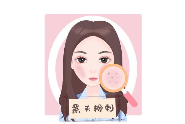 青春痘是怎么樣的 青春痘是螨蟲引起的嗎 青春痘是怎么樣的 青春痘是螨蟲引起的嗎