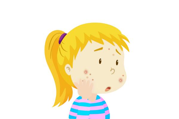 青春痘的原因是什么 青春痘的痘印怎么消除 青春痘的原因是什么 青春痘的痘印怎么消除