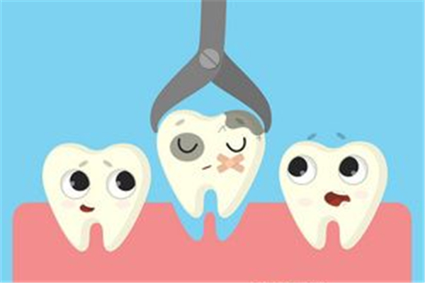 補牙前封牙是什么意思 補牙前為什么要塞藥一個星期 補牙前封牙是什么意思 補牙前為什么要塞藥一個星期