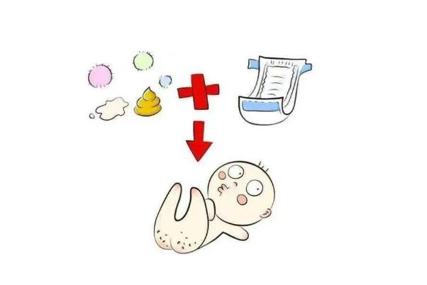 尿布疹要多久能好 尿布疹要換尿不濕品牌嗎 尿布疹要多久能好 尿布疹要換尿不濕品牌嗎