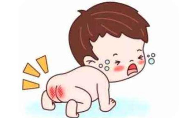 尿布疹的癥狀有哪些 尿布疹的預防要點是什么 尿布疹的癥狀有哪些 尿布疹的預防要點是什么