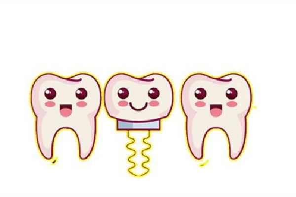 種牙會疼嗎 種牙后疼痛多長時間能好 種牙會疼嗎 種牙后疼痛多長時間能好