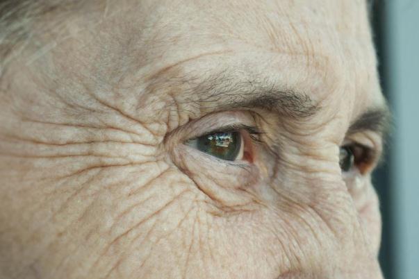 皺紋怎么樣才能去掉 皺紋是什么原因造成的 皺紋怎么樣才能去掉 皺紋是什么原因造成的