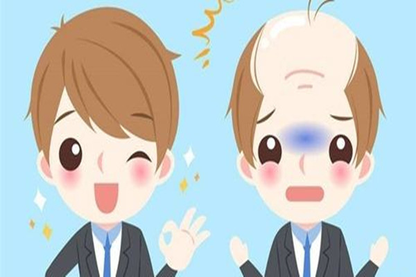 植發(fā)前需要做哪些準備 植發(fā)前驗血是要檢查什么 植發(fā)前需要做哪些準備 植發(fā)前驗血是要檢查什么