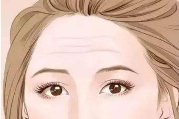 抬頭紋怎么形成的原因 抬頭紋怎么消除效果最好 抬頭紋怎么形成的原因 抬頭紋怎么消除效果最好