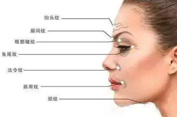 皺紋怎么樣才能去掉 皺紋是什么原因造成的 皺紋怎么樣才能去掉 皺紋是什么原因造成的