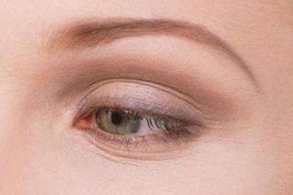 魚尾紋要怎樣淡化 魚尾紋要怎么食補(bǔ) 魚尾紋要怎樣淡化 魚尾紋要怎么食補(bǔ)