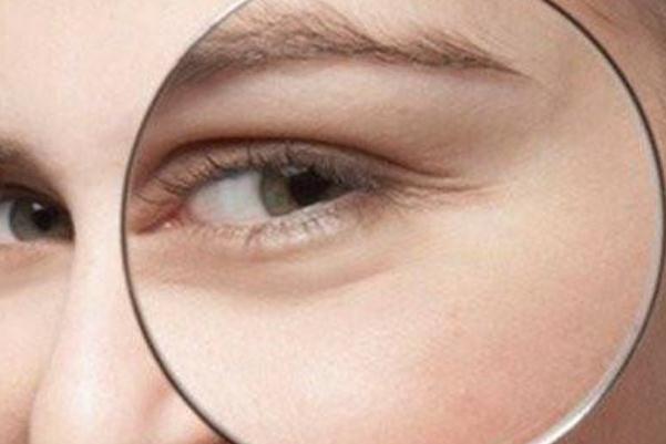 魚尾紋要怎樣淡化 魚尾紋要怎么食補(bǔ) 魚尾紋要怎樣淡化 魚尾紋要怎么食補(bǔ)