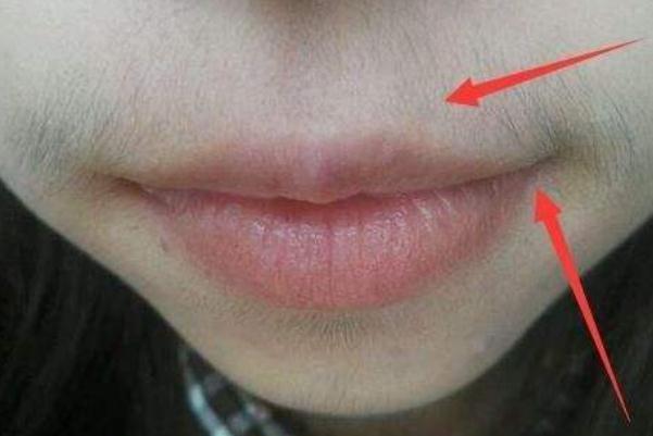 唇毛怎么去除永久 唇毛脫了會(huì)不會(huì)越長(zhǎng)越多 唇毛怎么去除永久 唇毛脫了會(huì)不會(huì)越長(zhǎng)越多