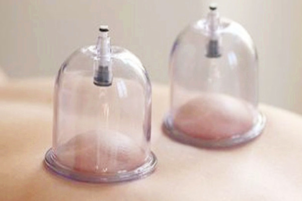 拔火罐后能不能喝酒 拔火罐后多久可以喝酒 拔火罐后能不能喝酒 拔火罐后多久可以喝酒