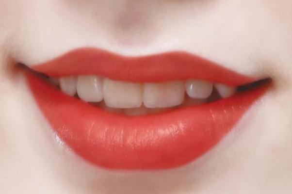 紋唇幾天能恢復好 紋唇幾天消腫 紋唇幾天能恢復好 紋唇幾天消腫