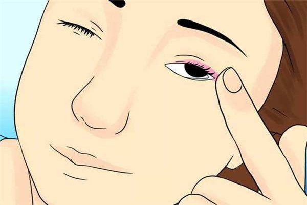 脂肪粒能用甘油去除嗎 脂肪粒發(fā)癢是怎么回事 脂肪粒能用甘油去除嗎 脂肪粒發(fā)癢是怎么回事