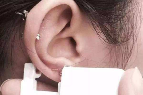 打耳骨后面長(zhǎng)了個(gè)肉坨坨怎么處理 打耳骨有什么風(fēng)險(xiǎn) 打耳骨后面長(zhǎng)了個(gè)肉坨坨怎么處理 打耳骨有什么風(fēng)險(xiǎn)