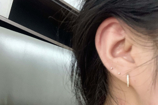 打耳骨疼嗎 打耳骨有什么危害 打耳骨疼嗎 打耳骨有什么危害